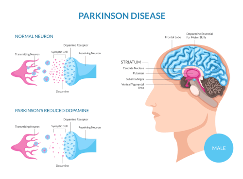 parkinson diseases